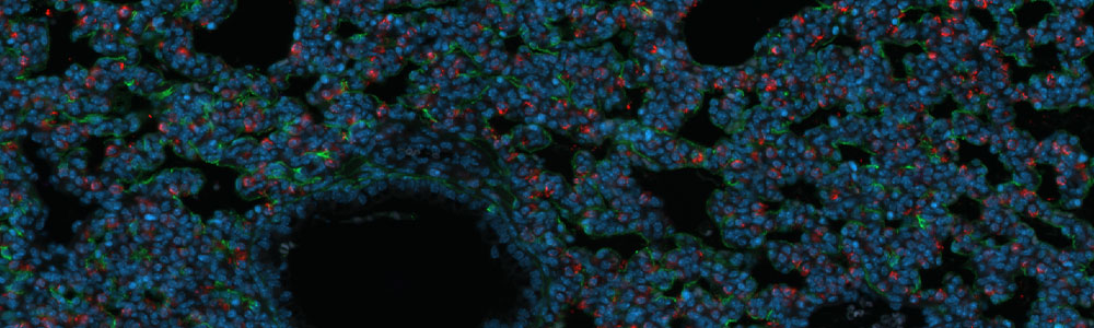 lung biology